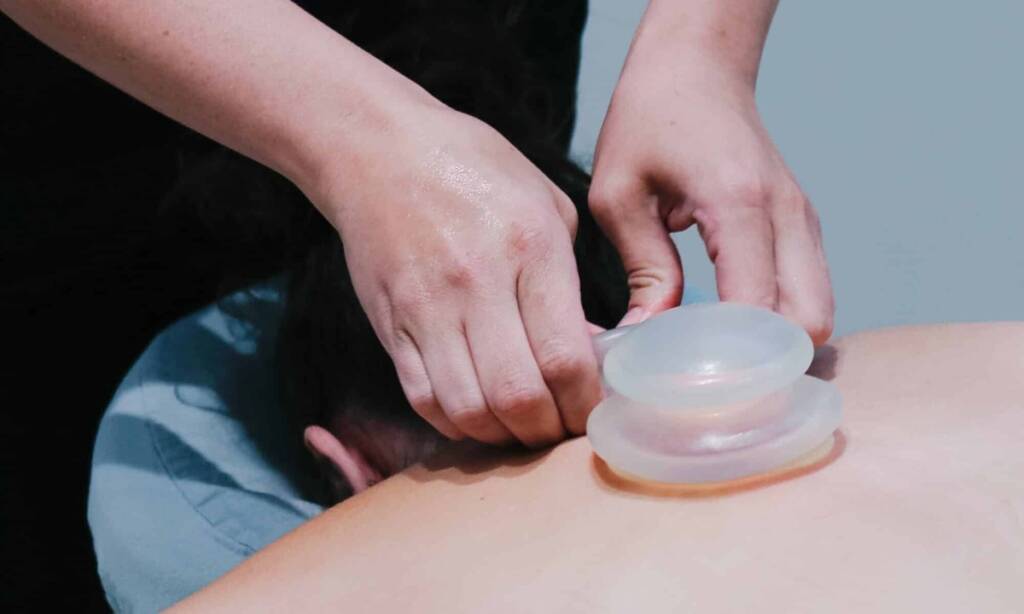 Close-up of cupping therapy suction cups on a client’s back for pain relief and muscle recovery
