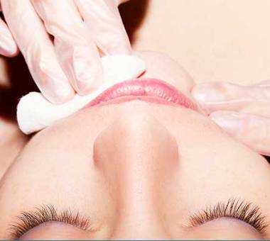 Chin waxing treatment for smooth, hair-free skin