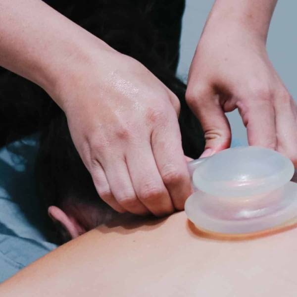 Close-up of cupping therapy suction cups on a client’s back for pain relief and muscle recovery